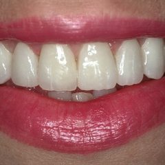 Forma Smile | Dentist in London - Dental Clinic London - Invisalign Specialist - Dental Care - Dental Boutique based in Central London EC2