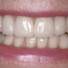 Forma Smile | Dentist in London - Dental Clinic London - Invisalign Specialist - Dental Care - Dental Boutique based in Central London EC2