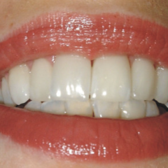 Forma Smile | Dentist in London - Dental Clinic London - Invisalign Specialist - Dental Care - Dental Boutique based in Central London EC2
